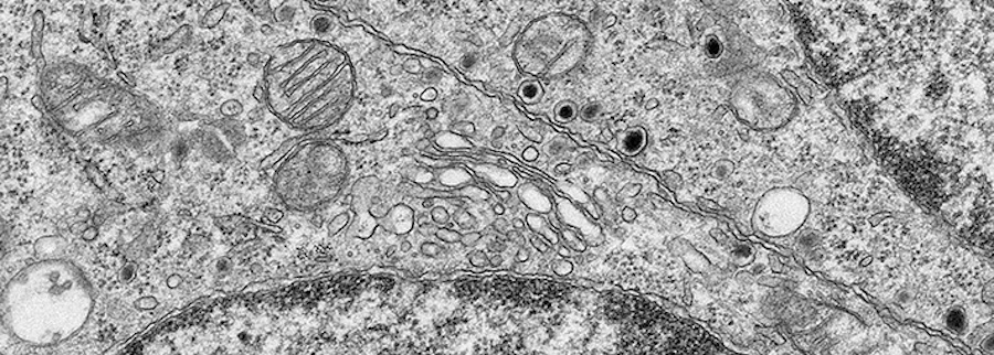 EM micrograph of Golgi and endoplasmic reticulum